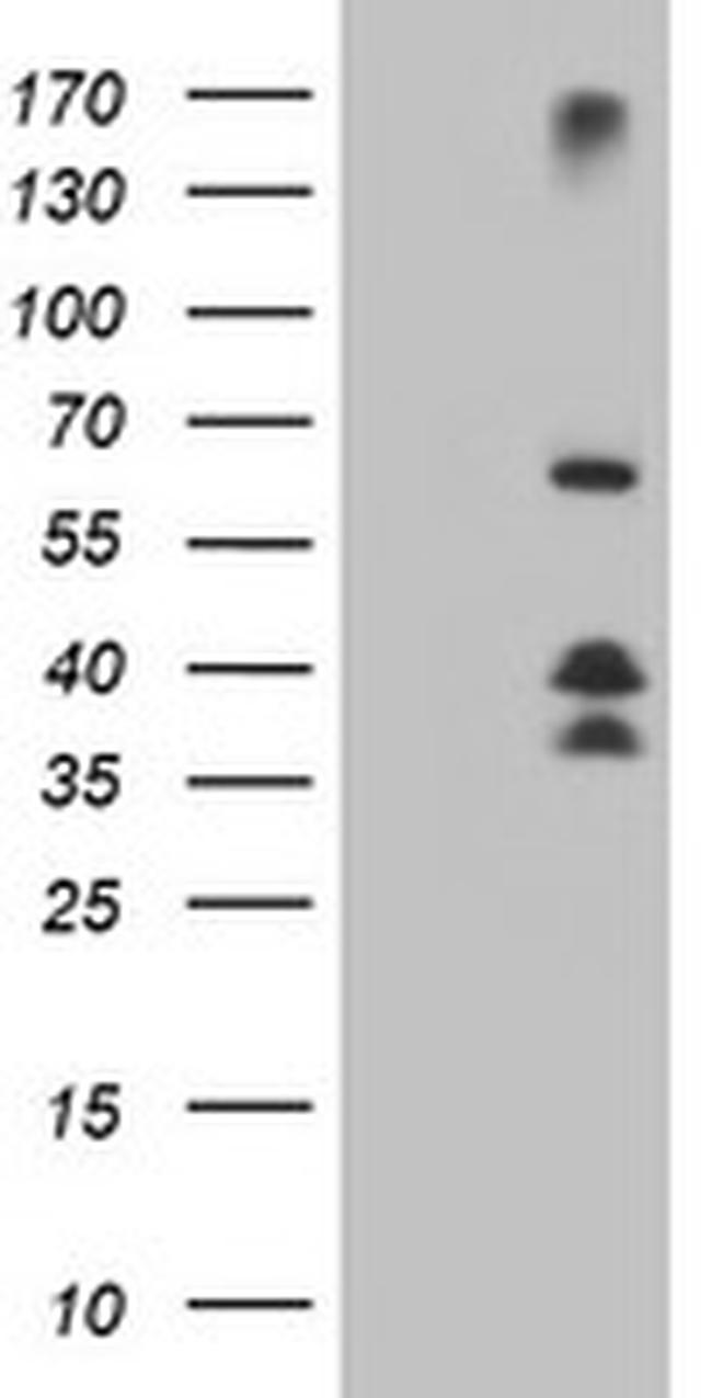 DTNB Antibody in Western Blot (WB)