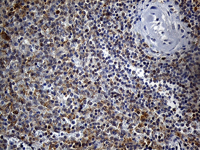 DTWD1 Antibody in Immunohistochemistry (Paraffin) (IHC (P))