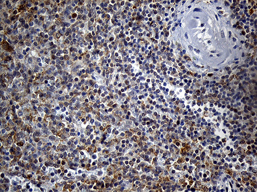 DTWD1 Antibody in Immunohistochemistry (Paraffin) (IHC (P))