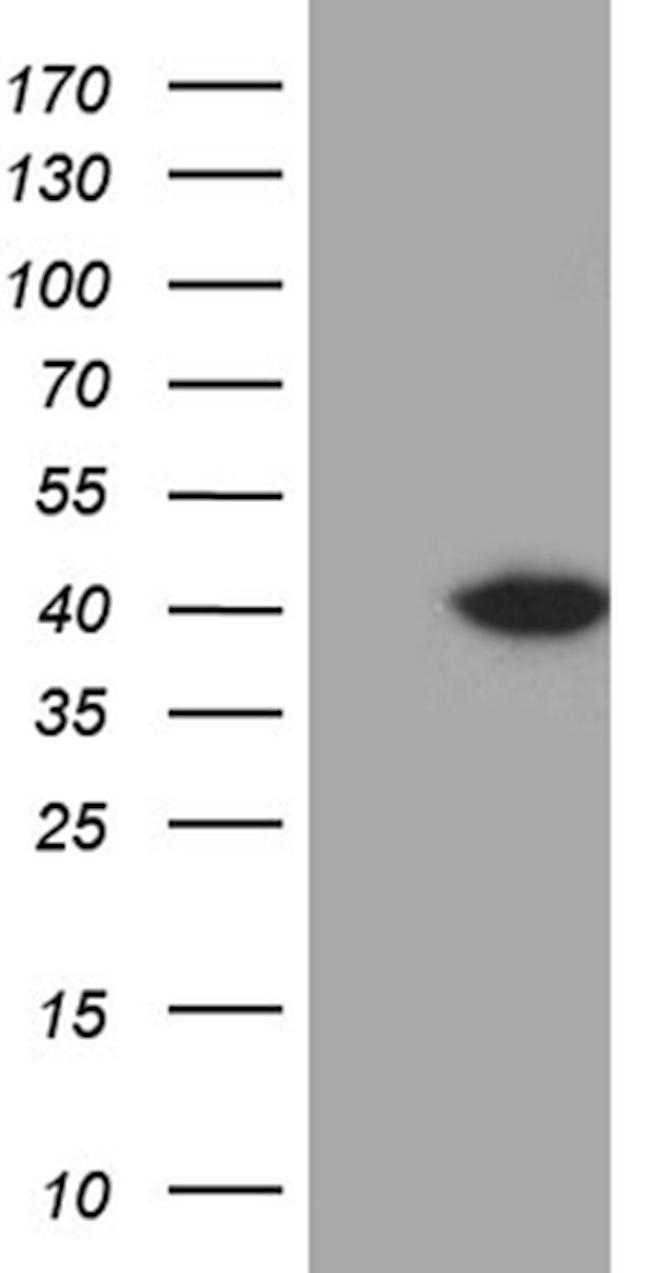 DTWD1 Antibody in Western Blot (WB)