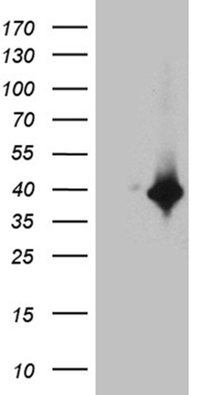DTWD1 Antibody in Western Blot (WB)