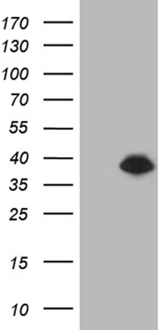 DTWD1 Antibody in Western Blot (WB)