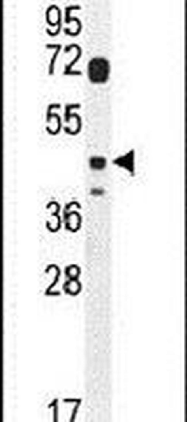 DTWD2 Antibody in Western Blot (WB)
