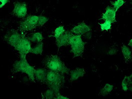 DTYMK Antibody in Immunocytochemistry (ICC/IF)