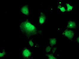 DTYMK Antibody in Immunocytochemistry (ICC/IF)