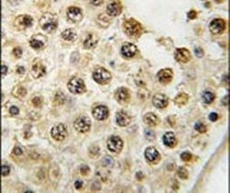 DUSP10 Antibody in Immunohistochemistry (IHC)