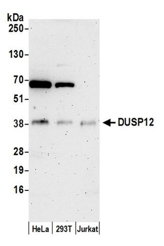 DUSP12 Antibody in Western Blot (WB)