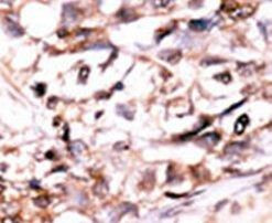 DUSP13 Antibody in Immunohistochemistry (IHC)