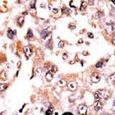 DUSP3 Antibody in Immunohistochemistry (IHC)