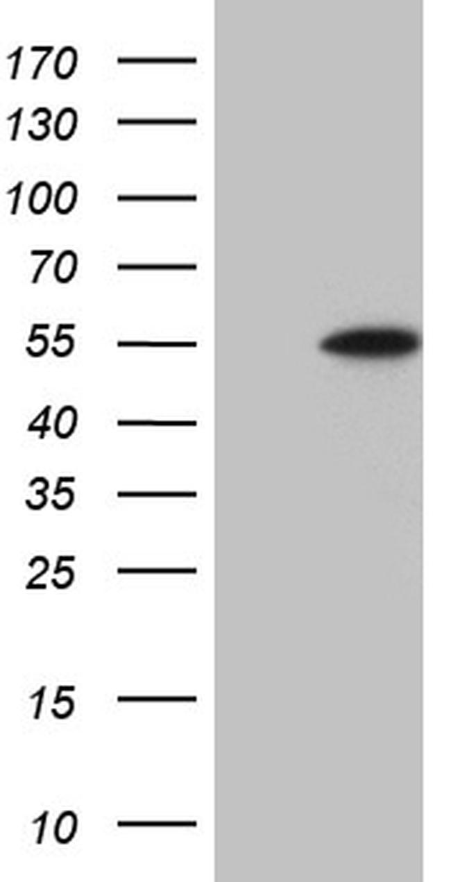 DUSP5 Antibody in Western Blot (WB)