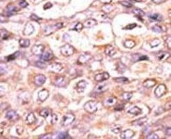 DUSP7 Antibody in Immunohistochemistry (IHC)