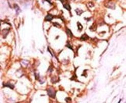 DUSP8 Antibody in Immunohistochemistry (IHC)