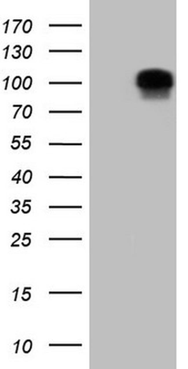 DVL2 Antibody in Western Blot (WB)