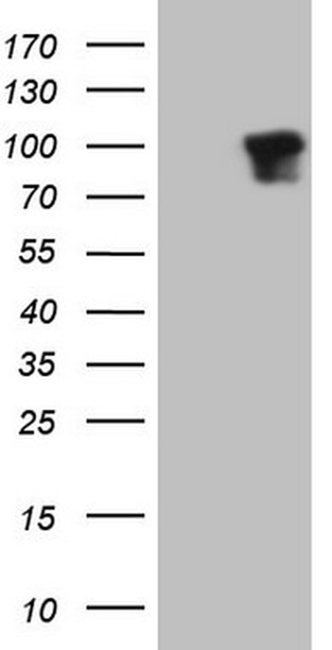 DVL2 Antibody in Western Blot (WB)