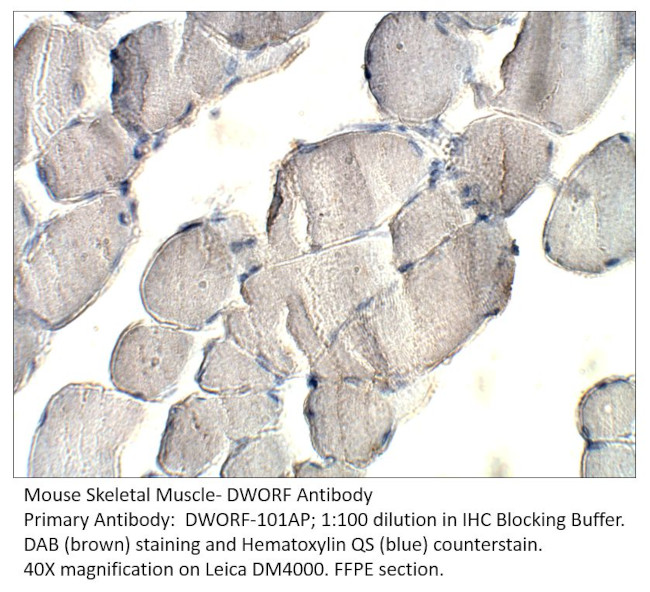 DWORF Antibody in Immunohistochemistry (IHC)