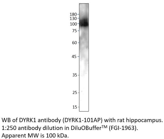 DYRK1 Antibody in Western Blot (WB)