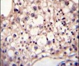 DYRK2 Antibody in Immunohistochemistry (IHC)