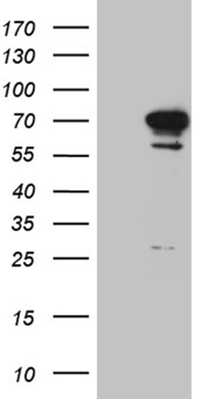 DYRK2 Antibody in Western Blot (WB)