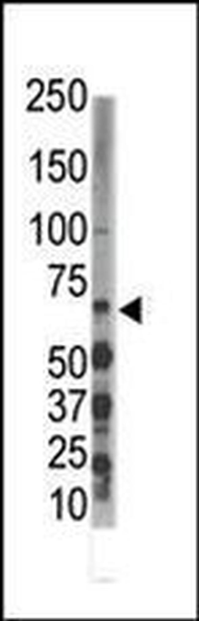 DYRK3 Antibody in Western Blot (WB)