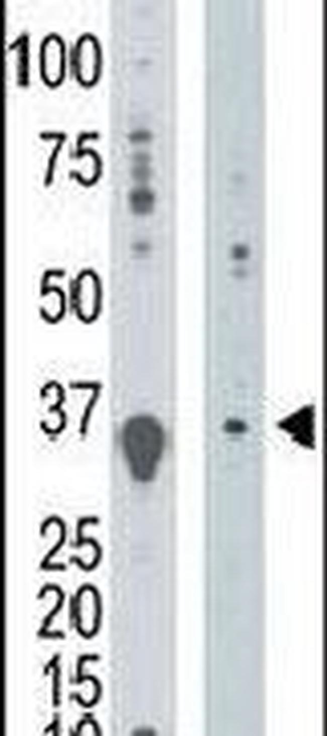 DGUOK Antibody in Western Blot (WB)