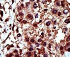 DGKI Antibody in Immunohistochemistry (IHC)