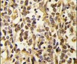 DNMT3A Antibody in Immunohistochemistry (IHC)