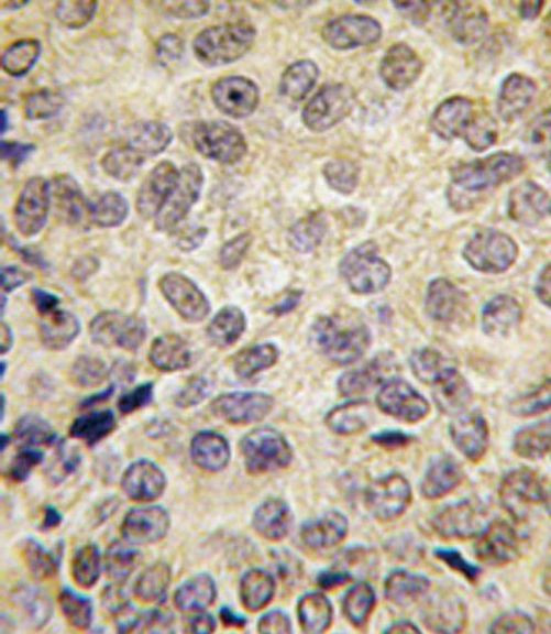 DNMT3B Antibody in Immunohistochemistry (IHC)