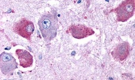 D4 Dopamine Receptor Antibody in Immunohistochemistry (Paraffin) (IHC (P))