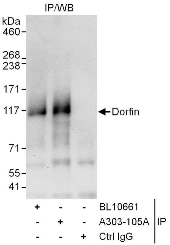 Dorfin Antibody in Immunoprecipitation (IP)