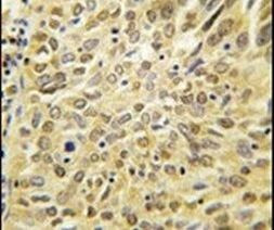 Ubiquilin 2 Antibody in Immunohistochemistry (IHC)