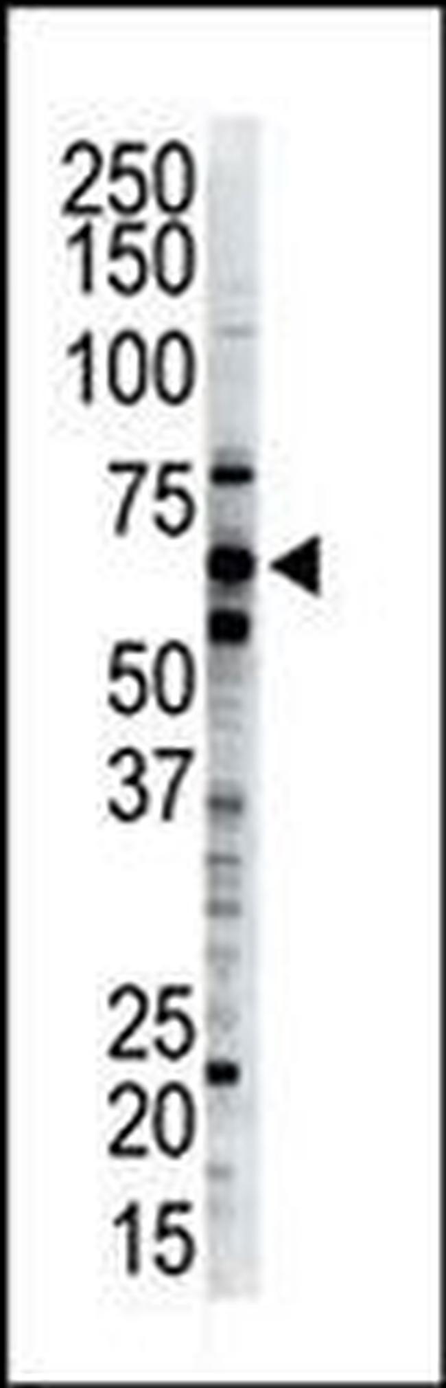 Ubiquilin 2 Antibody in Western Blot (WB)