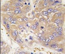 DTNBP1 Antibody in Immunohistochemistry (IHC)
