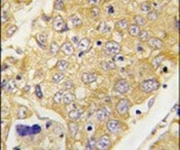 DTNBP1 Antibody in Immunohistochemistry (IHC)