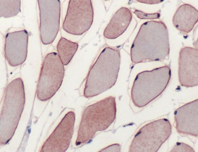 Dysferlin Antibody in Immunohistochemistry (IHC)