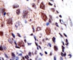 UBE2S Antibody in Immunohistochemistry (IHC)