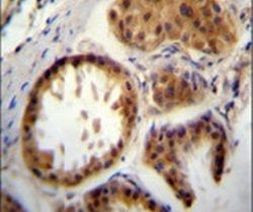 UBE2S Antibody in Immunohistochemistry (IHC)