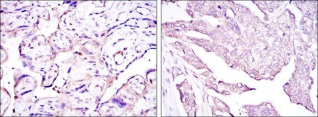 HPV Type 16 E7 Antibody in Immunohistochemistry (Paraffin) (IHC (P))