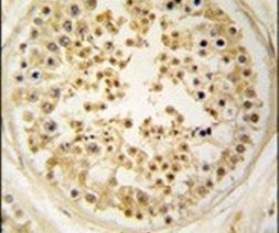 EARS2 Antibody in Immunohistochemistry (IHC)