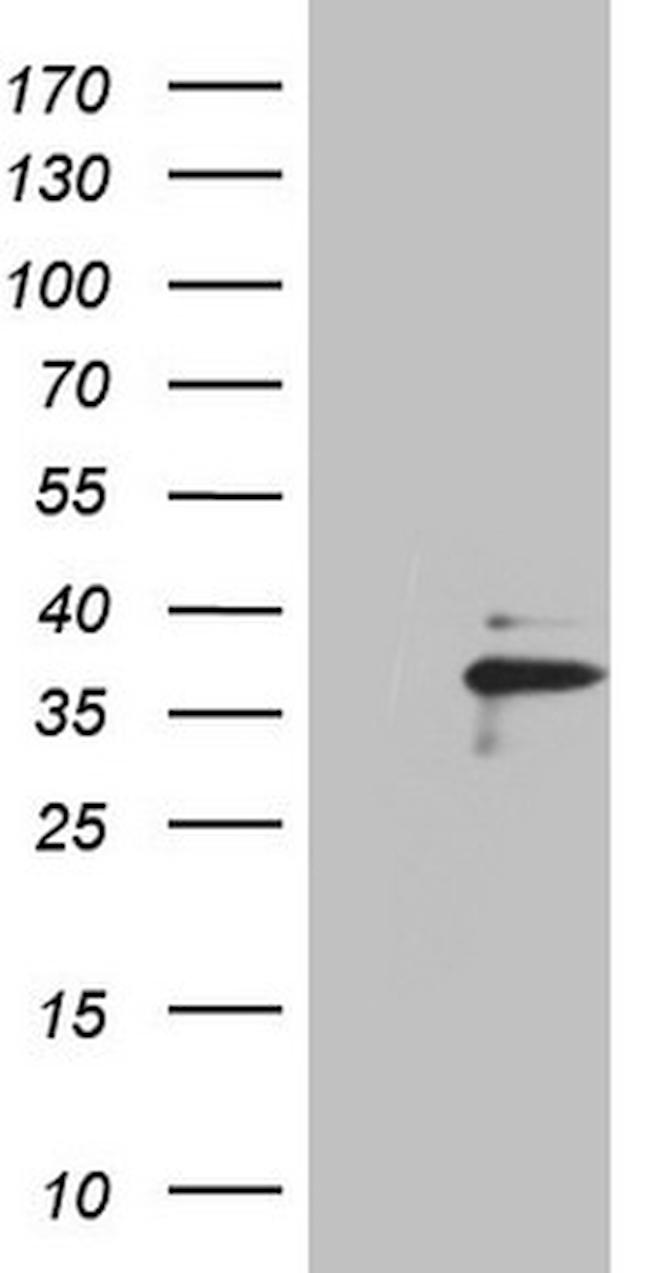 EBLN2 Antibody in Western Blot (WB)