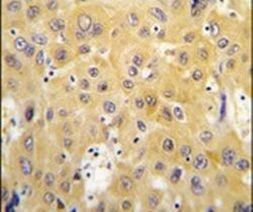 Thymidine Phosphorylase Antibody in Immunohistochemistry (IHC)