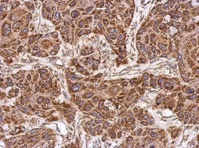 ECHDC1 Antibody in Immunohistochemistry (IHC)