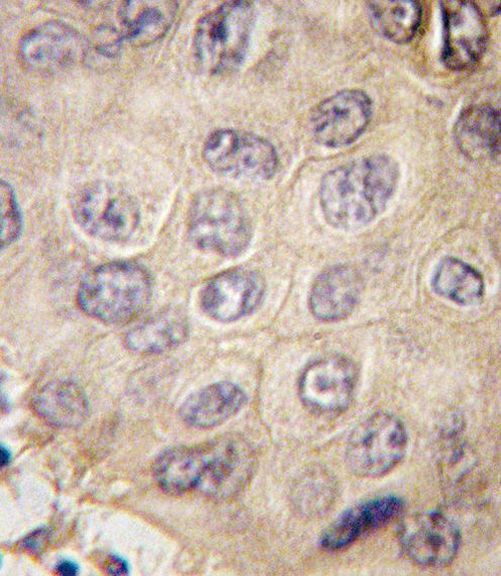 EDA Antibody in Immunohistochemistry (IHC)
