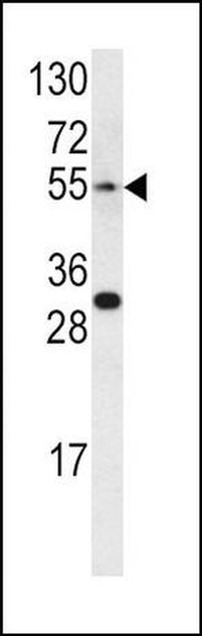 Endothelin A Receptor Antibody in Western Blot (WB)