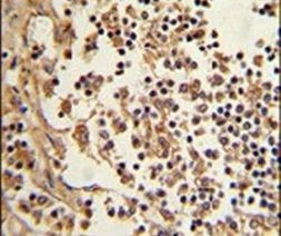 EEF1D Antibody in Immunohistochemistry (IHC)