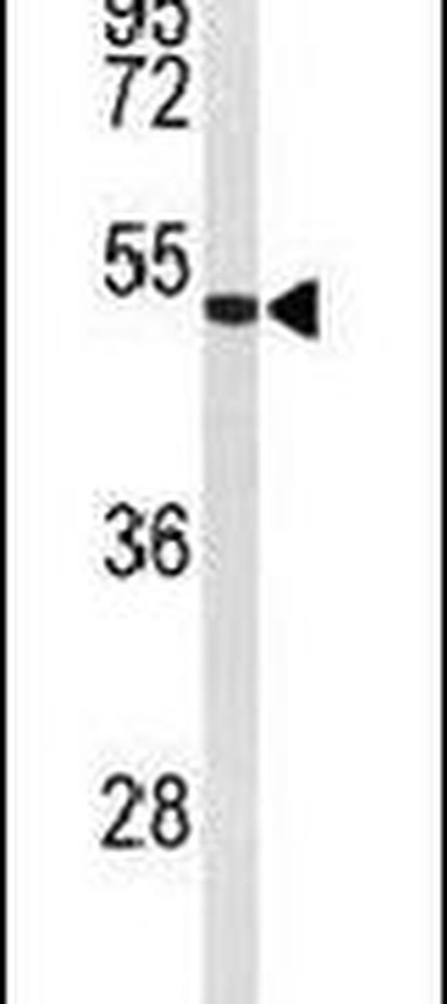 EFEMP2 Antibody in Western Blot (WB)