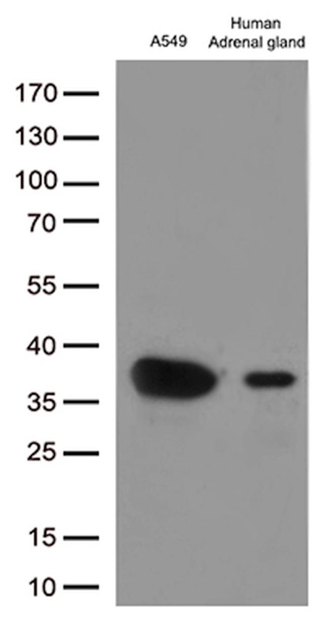 EFHD1 Antibody in Western Blot (WB)