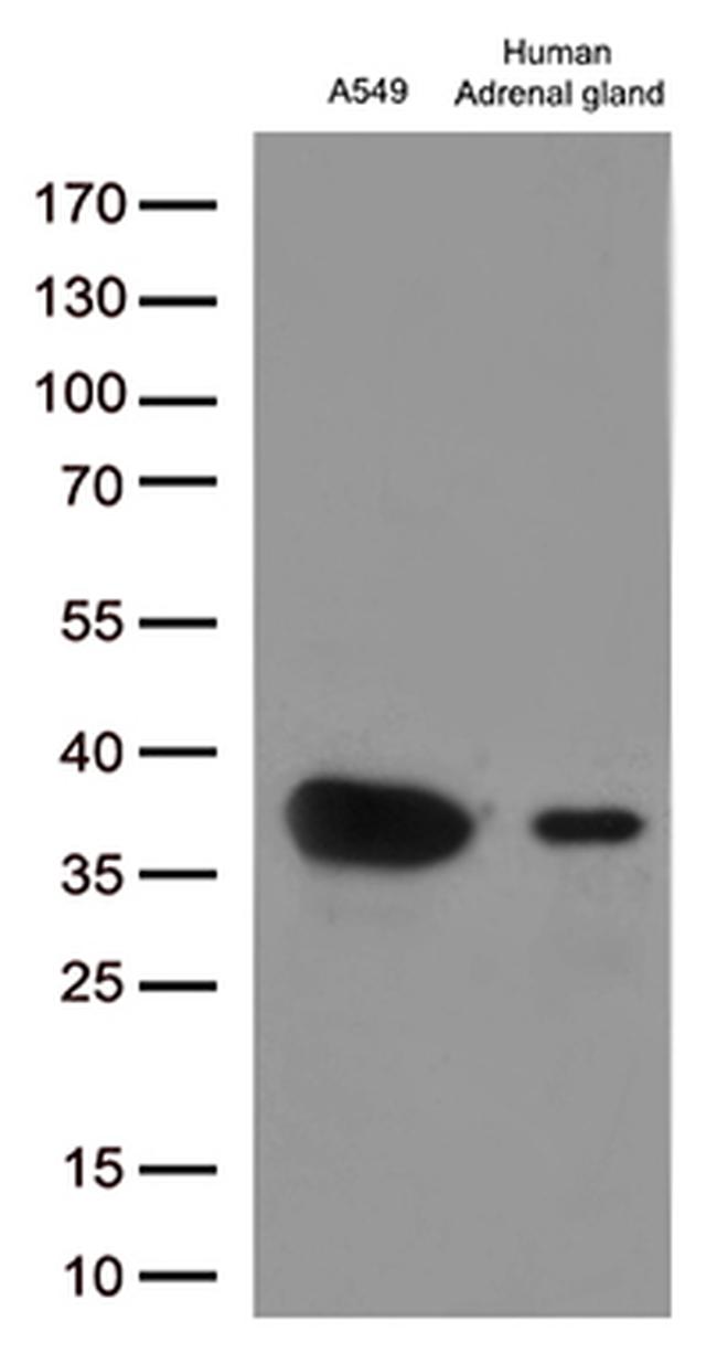 EFHD1 Antibody in Western Blot (WB)