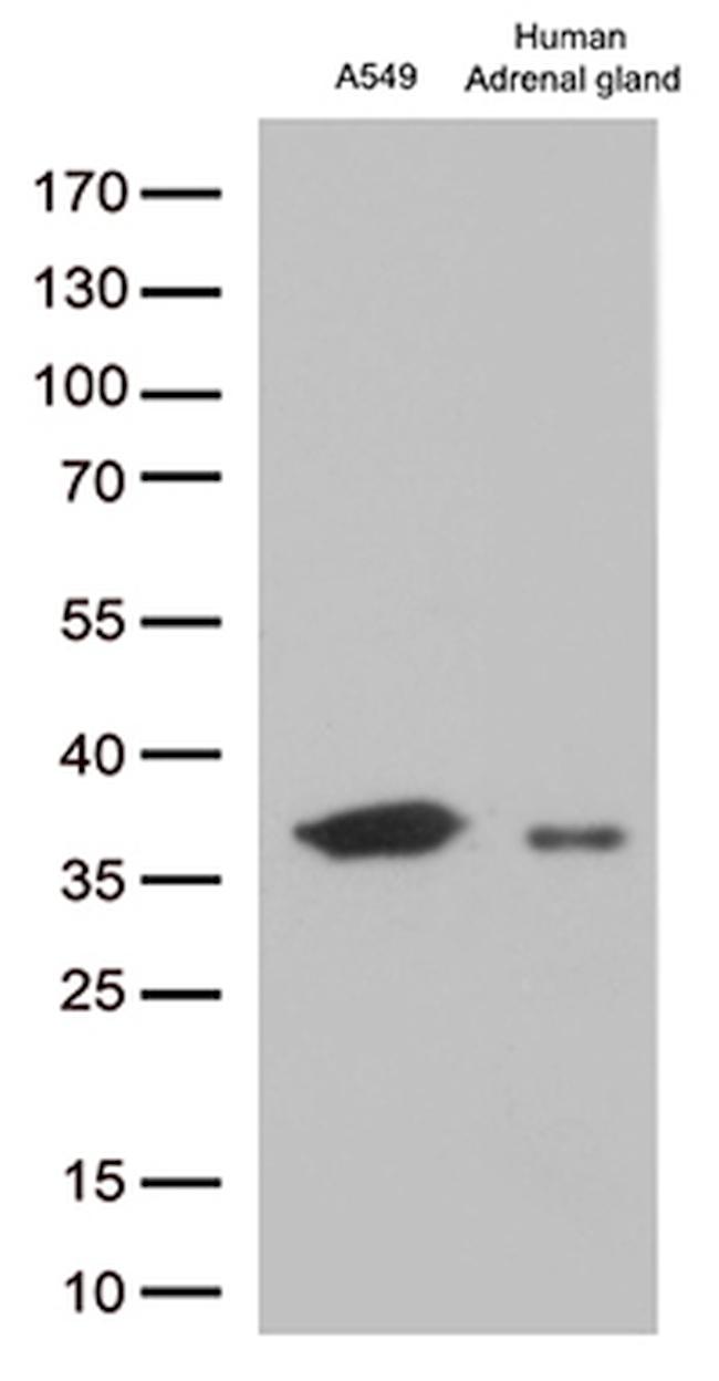 EFHD1 Antibody in Western Blot (WB)