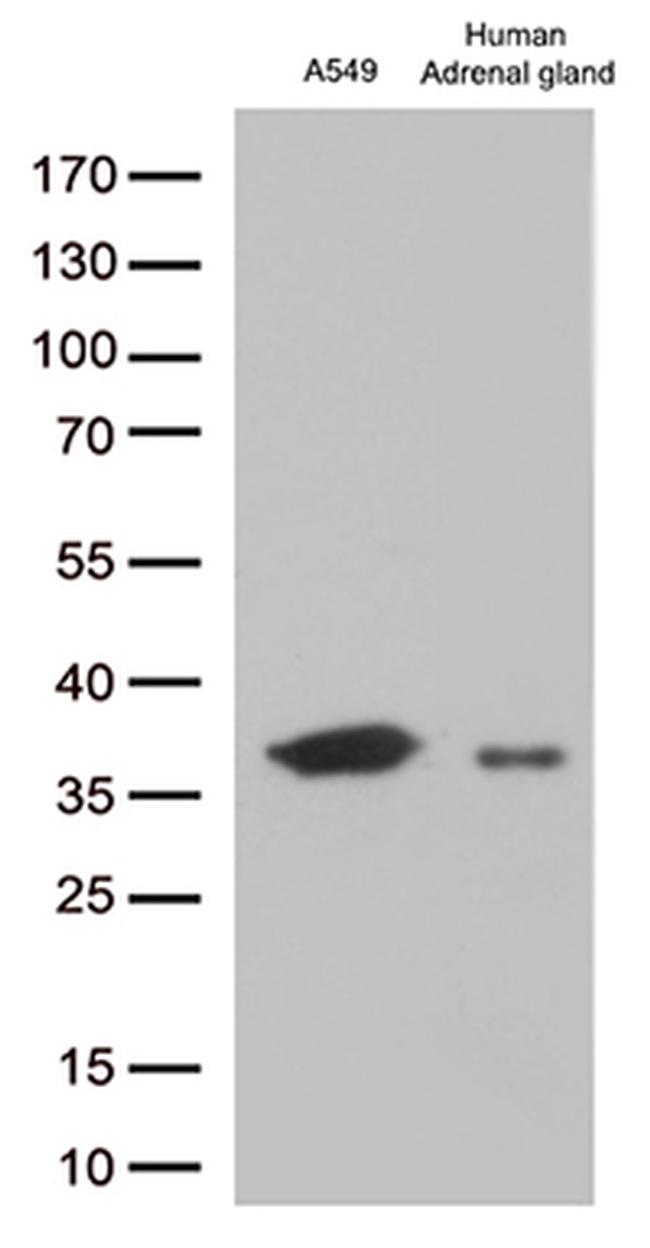 EFHD1 Antibody in Western Blot (WB)