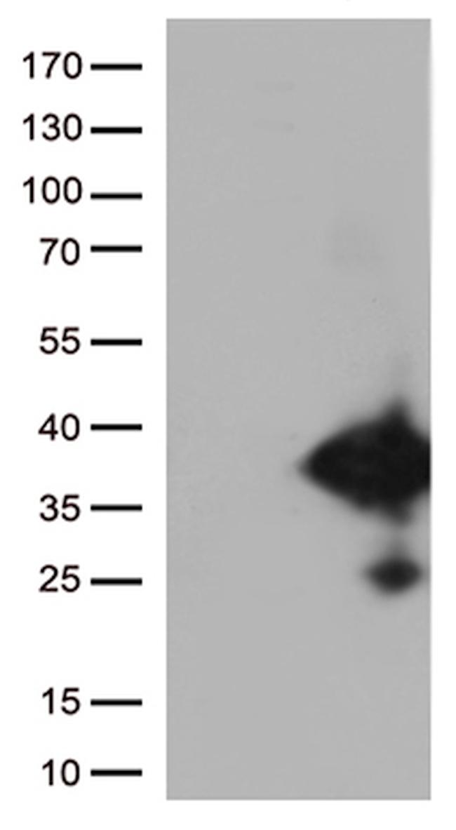 EFHD1 Antibody in Western Blot (WB)